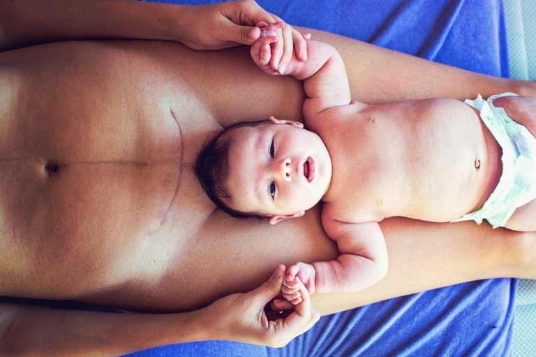 A baby lies on an adult's chest, holding their hands. The adult has a visible surgical scar down the center of their chest, likely from a c-section. They both appear to be lying on a blue surface, and the baby is wearing only a diaper. The image captures a tender bonding moment.